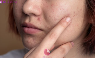 بهترین محصولات آرایشی برای مراقبت از پوست‌های حساس